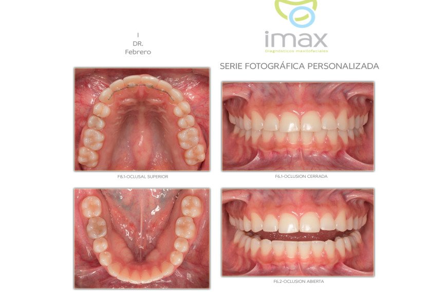 Series Fotográficas Personalizadas