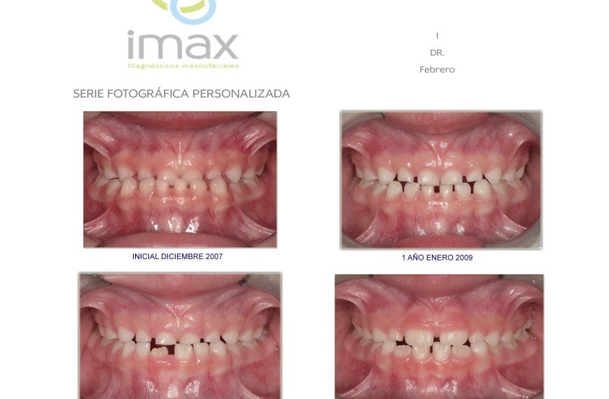 Seguimiento Fotográfico